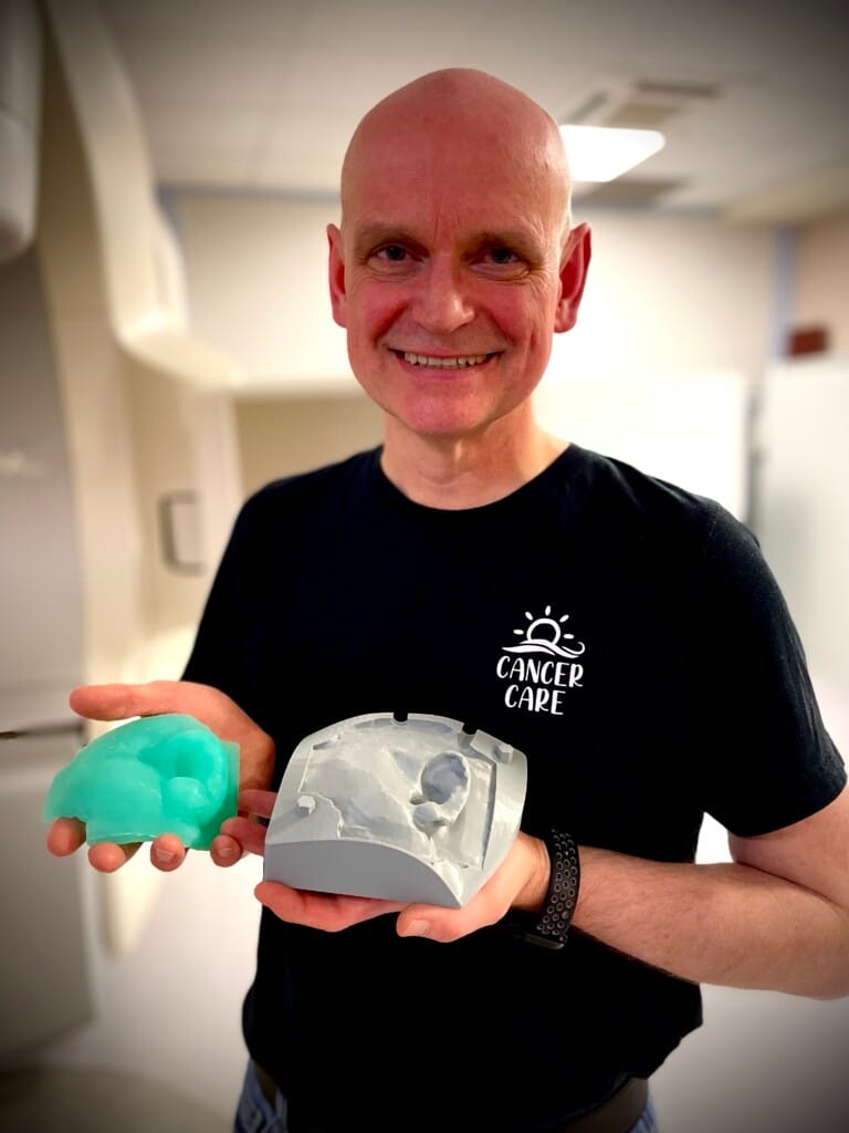 3D printed mold for radiation therapy